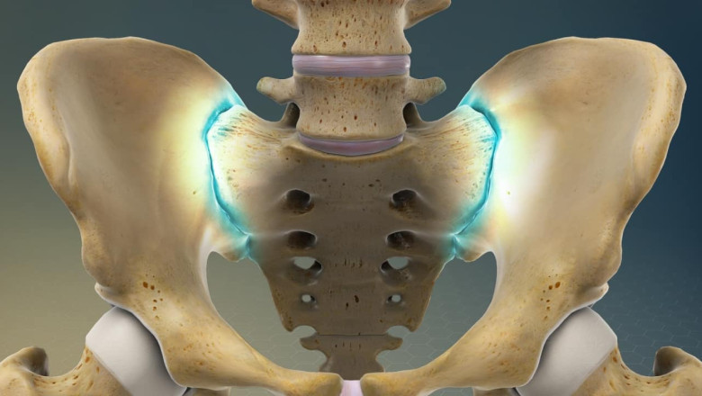 Global Sacroiliac Joint Fusion: An Emerging Treatment For Lower Back Pain | Times Square Reporter
