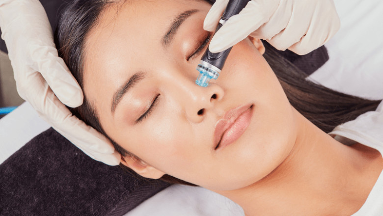 Skin Renewal: 5 Reasons Why Hydrafacial is Your Ultimate Solution